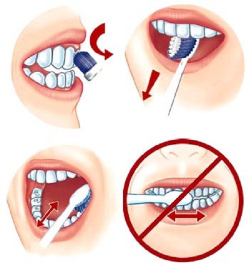 Tẩy trắng răng và những điều nên biết để tránh tiền mất tật mang-4
