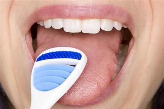 Hãy siêng cạo sạch lưỡi để tiêu diệt vi khuẩn tích tụ trên lưỡi gây hôi miệng.