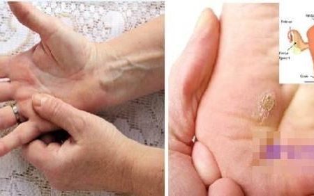 Cảnh báo: 7 dấu hiệu chứng tỏ bạn đang mắc ung thư cổ tử cung giai đoạn đầu
