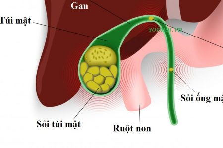 Chỉ nhờ vào áp dụng thải độc và ăn uống mà tôi gần 60 tuổi trông còn trẻ hơn thời con gái