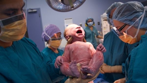 Sinh mổ giúp bé ra đời an toàn và nhanh chóng.